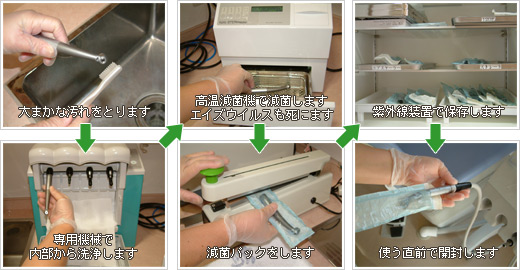 タービンの消毒の方法